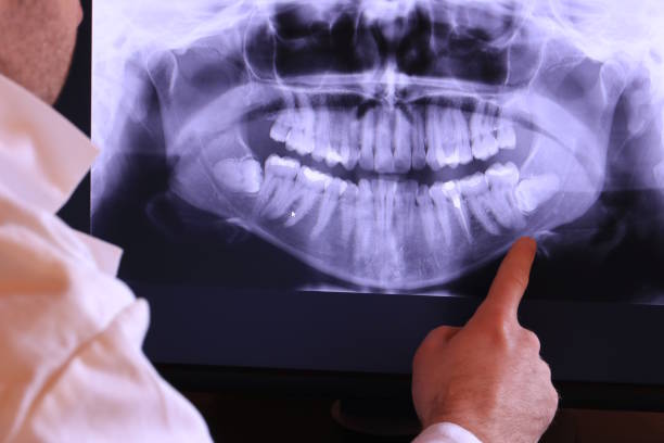 Best Emergency Treatment for Dental Infections or Abscesses in Ashley, PA
