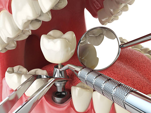 Best Emergency Dental Care for Broken or Chipped Teeth in Ashley, PA
